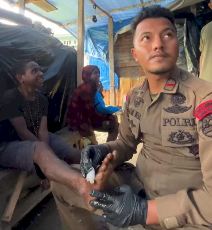 Peduli Kesehatan, Personel Ops Damai Cartenz 2025 Beri Pengobatan Anak Terluka di Intan Jaya